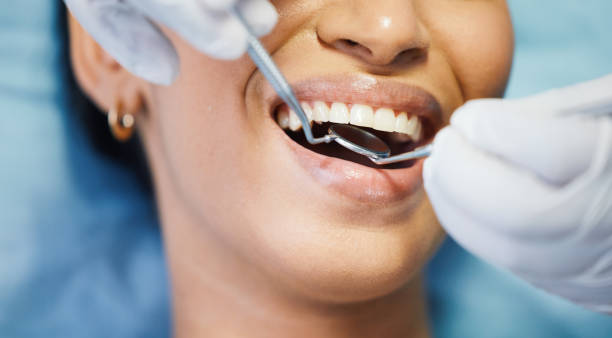 Best Emergency Broken Tooth Repair in Elysburg, PA